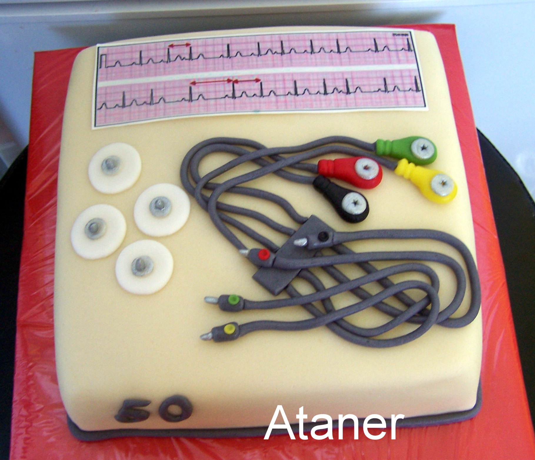 EKG